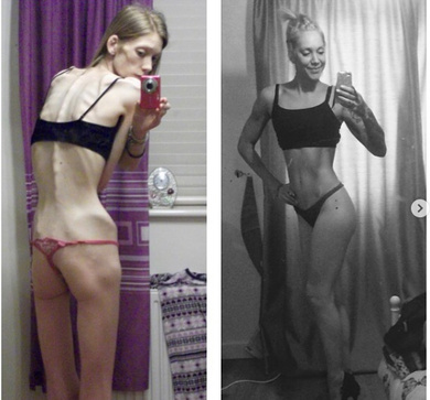 anorexica-6.jpg
